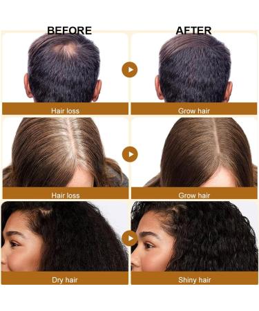 Go Ho Batana Oil for Hair Growth(50ml) Hair Growth Serum Hair Growth Oil with Castor Oil Coconut Oil for Women and Men Moisturizing & Strengthening Serum for Scalp & Hair Care - Buy Online on GoSupps.com