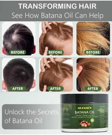 Buy Dr Sebi Batana Oil for Hair Growth | 100% Pure Organic Unrefined | 8.43 OZ - Enhance Hair Growth for Men & Women - Buy Online on GoSupps.com