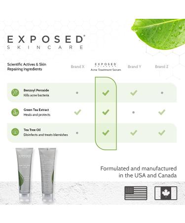 Exposed Skin Care Acne Treatment Serum – Lightweight Acne Spot Treatment with Micro Benzoyl Peroxide, Green Tea & Tea Tree Oil, Quickly Clears Pimples and Breakouts, 2.7 Fl Oz - Buy Online on GoSupps.com