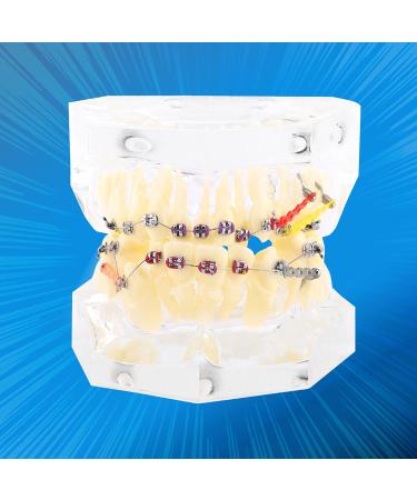 Orthodontic Treatment Weikeya Model | Harz Group PVC Teeth Learning - International Shipping Available - Buy Online on GoSupps.com