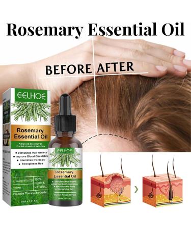 Pratvider Hair Growth Oil Rosemary Oil Rosemary Oil for Hair Growth Rosemary Hair Oil Nourish Scalp Hair Care Oil for Men Women 30ml - Buy Online on GoSupps.com