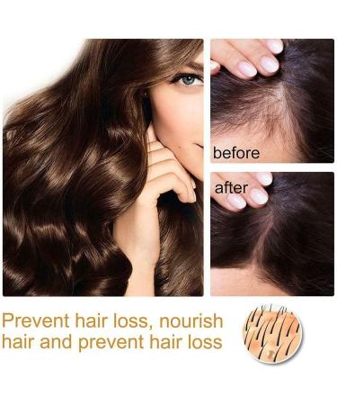 Xltyyds Puraect Fermented Rice Water Serum - Biotin Hair Growth Enhancer for Thinning Hair & Hair Loss (10ml 2PCs) - International Shipping Available - Buy Online on GoSupps.com