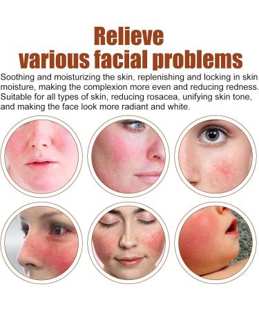 Rosacea Face Serum Face Serum Hyaluronic Acid Face Oil Anti-Aging Relieve Redness &Quick Repair Damage Skin Niacinamide Serum Replumps & Hydrates Collagen Face Serum-Protect Skin+Reduce Acne-Women 1 - Buy Online on GoSupps.com