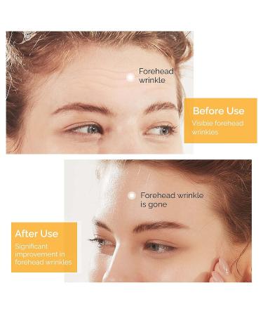 Hydrolyzed Collagen Forehead Wrinkle Patches - 20 PCS | Anti-Wrinkle Face Patches for Men & Women | Smooth Fine Lines & Wrinkles Naturally - Buy Online on GoSupps.com