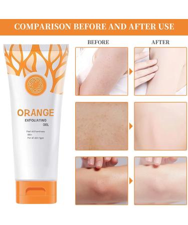 Orange Exfoliating Gel - Natural Peeling Scrub for Face & Body | Deep Cleansing & Moisturizing for Radiant Skin - Buy Online on GoSupps.com