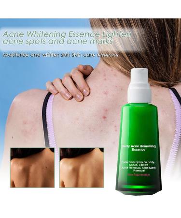 Brightening Facial Essence for Pale Skin | Vitamin-Enriched Aluminum Formula | Reduces Dark Circles & Restores Elasticity - Buy Online on GoSupps.com