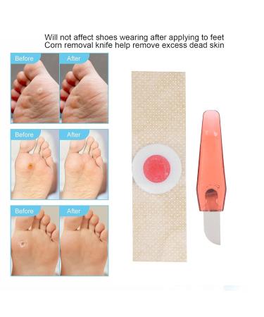 Fast & Effective Chicken Eye Paving Safe Corn Remote Pads for Toes | All-Day Protection Against Shoe Friction - Buy Online on GoSupps.com