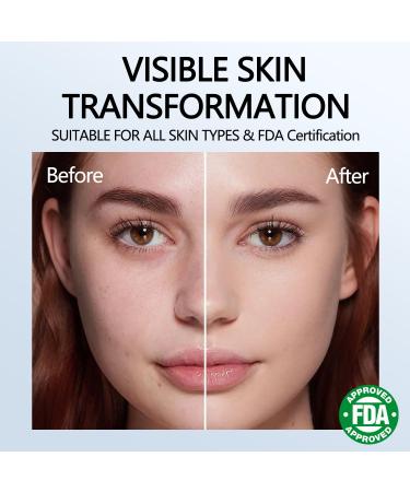 2 Pcs Peel Shot Glow Rice Ampoule Duo White & Black Rice Exfoliant for All Skin Types Gentle Peel & Deep Hydration Dead Skin Cells Remover - Buy Online on GoSupps.com