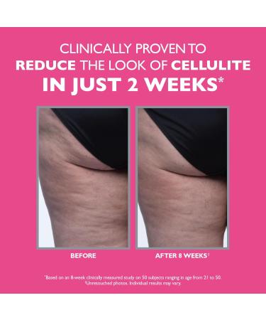 Peter Thomas Roth | FIRMx Tight & Toned Cellulite Treatment Body Cream Clinically Proven to Reduce the Look of Cellulite In Just 2 Weeks - Buy Online on GoSupps.com