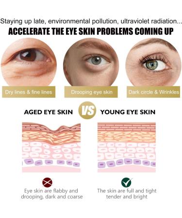 Retinol Eye Cream Anti Aging Eye Cream with Retinol Serum Aha 30% & Bha 2% Under Eye Cream for Women/Men Skincare Eye Cream for Dark Circles Puffy Eyes Reduce Fine Lines Brightening Eye Repair Cream - Buy Online on GoSupps.com