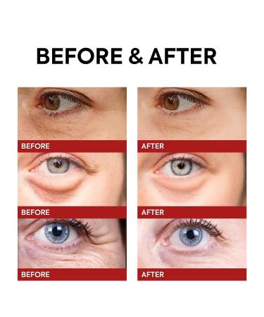 Rapid Reduction Retinol Eye Cream | Instant Wrinkle & Puffiness Relief | Dark Circles & Crow s Feet Treatment - 1 OZ/15G - Buy Online on GoSupps.com