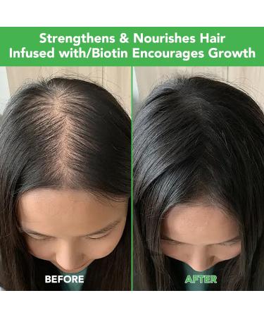 100% Pure Organic Rosemary Shampoo Set for Hair Regrowth - Hair Thinning & Loss Treatment with Growth Oil (10.56 fl.oz) - International Shipping Available - Buy Online on GoSupps.com