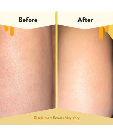 Honey Soothing Body Wash for Eczema Relief - Gentle Shower Gel for Sensitive Skin - For Adults, Kids & Babies - 13 Fl Oz - Buy Online on GoSupps.com