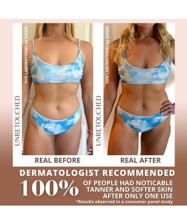 Sun Laboratories Ultra Dark Sunless Tanning Lotion + Mitt - 32 fl oz Bottle - Golden Glow - Dark - Buy Online on GoSupps.com