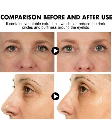 Anti-aging eye cream eye cream for wrinkles and dark circles eye cream anti-aging eye care duo for day and night reduces bags under the eyes wrinkles and fine lines - Buy Online on GoSupps.com