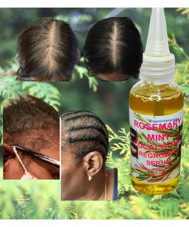 Rosemary Mint Eucalyptus Hair Oil | Thicker Longer & Fuller Hair | Nourishes Split Ends & Dry Scalp - 2 fl oz - Buy Online on GoSupps.com