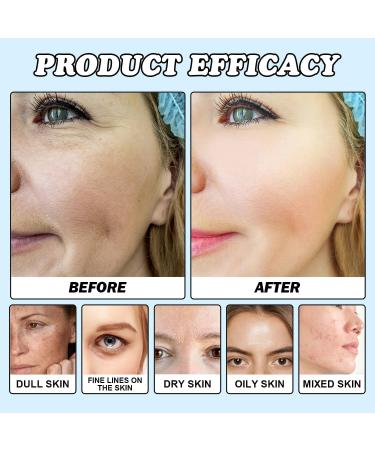  1/2Pcs Advanced Firming & Wrinkle-Reducing Cream Skin Firming Rejuvenating Cream Skin Firming Rejuvenating Serum Deep Hydration Skin Firming Rejuvenation for All Skin Types 50ML/1.69FL.OZ (2Count (Pack of 2)) - Buy Online on GoSupps.com