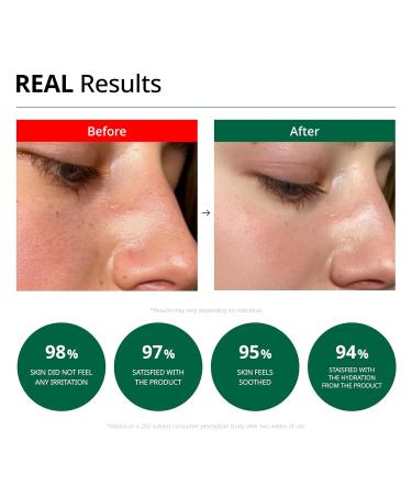 Dr.G RED Blemish Clear Soothing Cream 70ml - Cica Moisturizer for Sensitive Acne-Prone Skin | Korean Skin Care & KBeauty - Buy Online on GoSupps.com