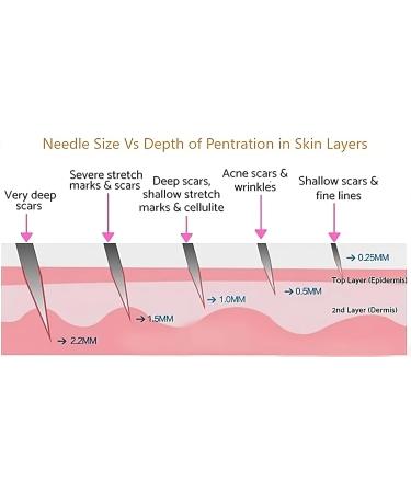 Derma Roller 1.00MM Hair Growth Men and Women 540 Titanium Micro Needling roller for Hair growth Beard roller for Skin Care and Beard Growth Universal Roller with Carry Case (DERMA 1MM) - Buy Online on GoSupps.com