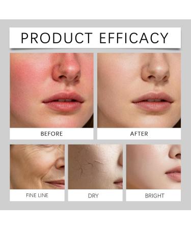 rabuu Hydrating Face Moisturizer Cream - Nourishing Lightweight Non-Greasy Formula For Smooth Skin Reduces Fine Lines Daily Hydration - Buy Online on GoSupps.com