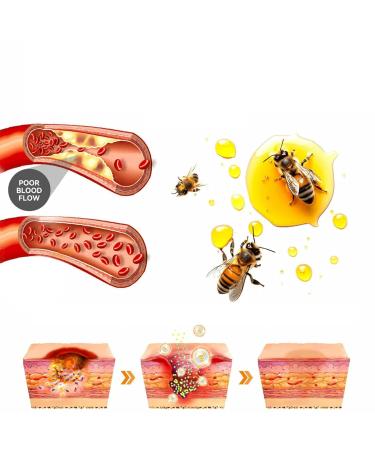 FROPUN Bee Venom Treatment Cream | Acne & Skin Repair | Hydrating Cream for Men & Women | 1 Fl Oz - Buy Online on GoSupps.com