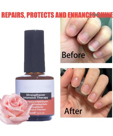 Nail Strengthening Treatment with Vitamin E | Repair, Strengthen & Grow Nails | Reduce Cracks & Splits | Vegan Formula - Buy Online on GoSupps.com