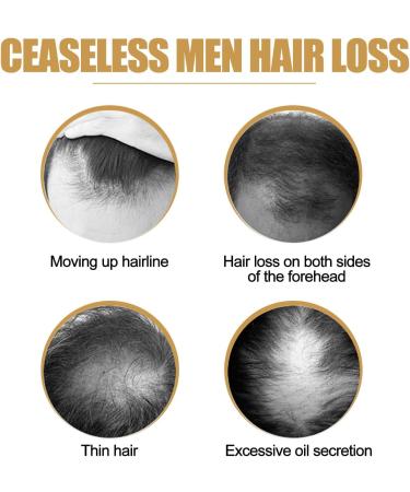 Joyivike Hair Shampoo Soap Ginger Shampoo Soap for Hair Regrowth Ginger Shampoo Soap for Hair Growth Ginger Solid Shampoo for Men and Women - Buy Online on GoSupps.com