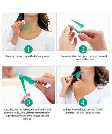 Buy La. Personal Warts Review Kit - Skin Tag Remover with 40 Repair Patches Safe & Painless for All Body Parts (2mm to 8mm) - Buy Online on GoSupps.com