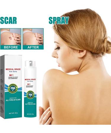 2pcs Advanced Scar Remove Spray & Cream Set (20g) - Physician Formulated Acne Scar Removal Gel | Moisturizing & Diminishing Results - Buy Online on GoSupps.com