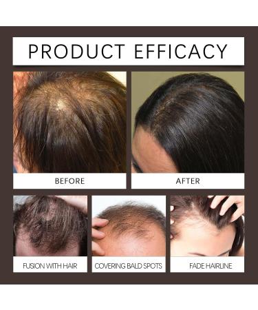 14 Colors Hairline Powder with Mirror - Quick Cover Root Concealer for Men & Women | Light Blonde Hair Touch Up (4g - Buy Online on GoSupps.com