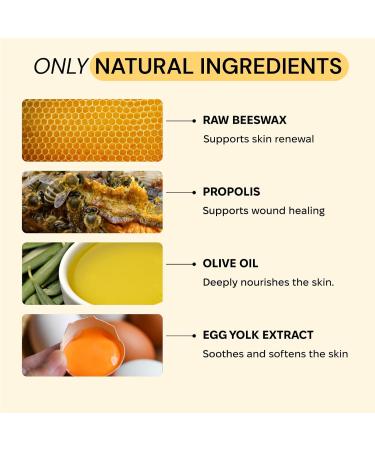 MyMagicHealer Universal Flare Care | Essential Oil Free | Relief for Rashes, Eczema, Psoriasis, Hidradenitis Suppurativa, Impetigo, Dermatitis, Wound Care, Sensitive Skin w/Propolis & Egg Yolk 4 oz 4 Ounce - Buy Online on GoSupps.com