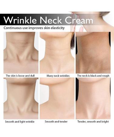 Spain NECKPON Hydrolized Collagen Neck Cream - Neck Firming Anti-Wrinkle Anti-Aging Moisturizer (3PCS) - Buy Online on GoSupps.com