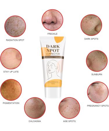 Beslibate Whitening Cream 60 ml whitening cream moisturizing cream for an even radiant complexion reduces dry lines for the face for women and men cream 58 - Buy Online on GoSupps.com