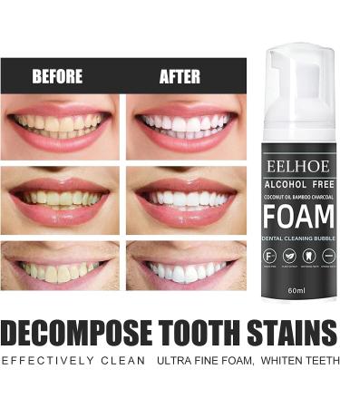 Whitening Toothpaste - Bamboo Charcoal Formula for White Teeth | Effective Protection & Deep Cleaning - Buy Online on GoSupps.com
