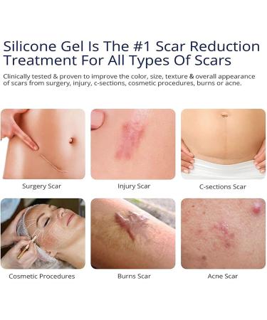  Facynde Face Scar - Scar Cream Anti Scar Gel Cream Scar Reduction Advanced Postoperative Supplies Facial Scar Management Facyn - Buy Online on GoSupps.com