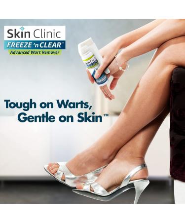 Skin Clinic FREEZE n CLEAR Advanced Wart Remover - #1 Wart Removal Technology | 12 Precision Applicators - Buy Online on GoSupps.com