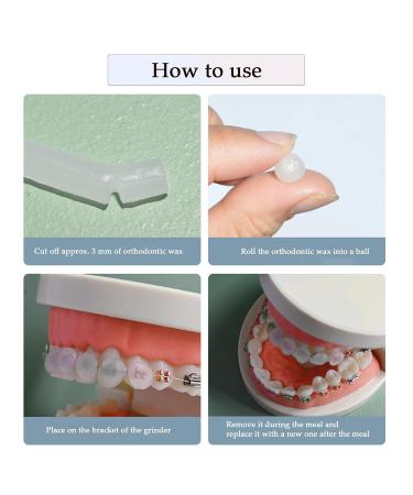 10 Boxes Odorless Orthodontic Wax - 50 Strips Dental Care for Braces & Aligners - Prevent Mouth Injury - Buy Online on GoSupps.com
