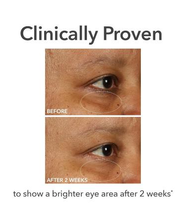 Dr Dennis Gross DermInfusions Fill + Repair Eye Cream: Hydrating & Brightening Treatment for Dark Circles Fine Lines & Wrinkles Firms & Smooths 360 Eye Area 0.5 Oz - Buy Online on GoSupps.com