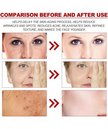 AHA 30% + BHA2% Peeling Solution Exfoliating Facial Serum for Hydrated Serum for Face Face Serum for Hydrated for Women Peeling Solution and Hyaluronic Face Serum Gentle Facial Oil for Large Pores - Buy Online on GoSupps.com