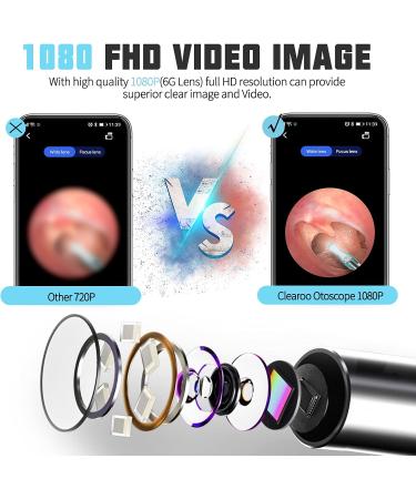 Ear Wax Removal Tool Burdee Ear Cleaner with Scope Camera 1080P FHD Portable Wireless Visual Ear Otoscope Pen Compatible with iPhone Android Smart Phones Suitable for Kids Adults - Buy Online on GoSupps.com