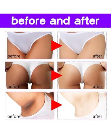 Snow Bleach Cream Whitening Cream for Intimate Parts Whitening Cream for Intimate Parts Intimate Cream for Women Irritation Bleaching Cream for Intimate Areas 60g (3pc) - Buy Online on GoSupps.com