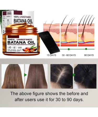 Batana Oil for Hair Growth | Prevent Dryness & Split Ends - Pure Natural Formula - Buy Online on GoSupps.com