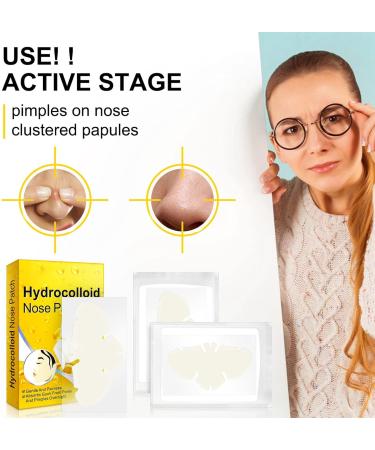 12pcs Hydrocolloid Nose Patches for Blackhead Removal and Deep Cleansing - Ideal for Oily Skin - Buy Online on GoSupps.com