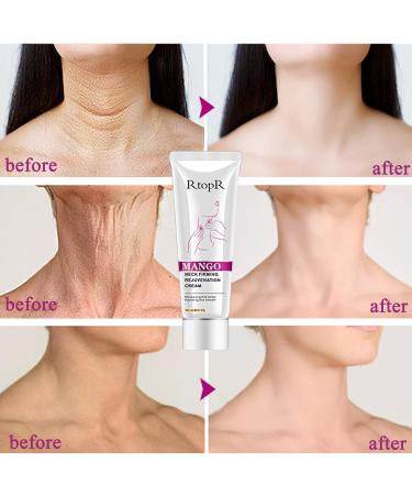 Neck Firming Cream for Wrinkle-Free, Tightened Skin - Anti Wrinkle and Double Chin Reducer - Buy Online on GoSupps.com