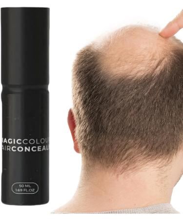 Hair Runner - 50ml balm to improve the hairline | Corrective cream for the | Naturally fuller retaining fibers and to thin the scalp - Buy Online on GoSupps.com