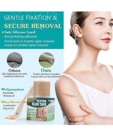 Emibele Silicone Scar Sheets 1.6x120 Roll-3M | Professional Scar Tape for Keloid, Acne, Surgery Scars | Soft & Breathable Silicone Gel Strip for Scar Removal - Buy Online on GoSupps.com