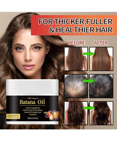 Batana-oil For Hair Growth And Repair - Natural Batana-oil Batana Anti Loss Hair Oil For Visibly Thicker And Stronger Hair Prevent Hair-Loss all Hair Types - Buy Online on GoSupps.com