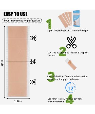 Silicone Scar Sheets - Reusable Scar Removal Strips for Surgical Scars, Keloids, C-Section, Acne, Stretch Marks - Pack of 4 - Buy Online on GoSupps.com