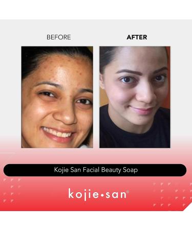 Kojie San Skin Brightening Soap - Original Kojic Acid for Dark Spots - 3 Bars 65g with Coconut & Tea Tree Oil - Buy Online on GoSupps.com