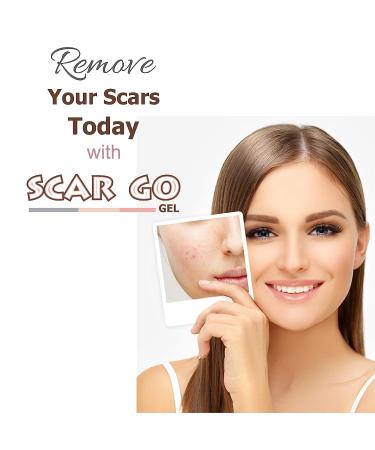 SS Anti-Scar Gel for Skin Lightening - 15 GM | For Old & New Scars, Keloids, Acne, Surgery Marks & Burns | Suitable for All Skin Types - Men & Women - Buy Online on GoSupps.com